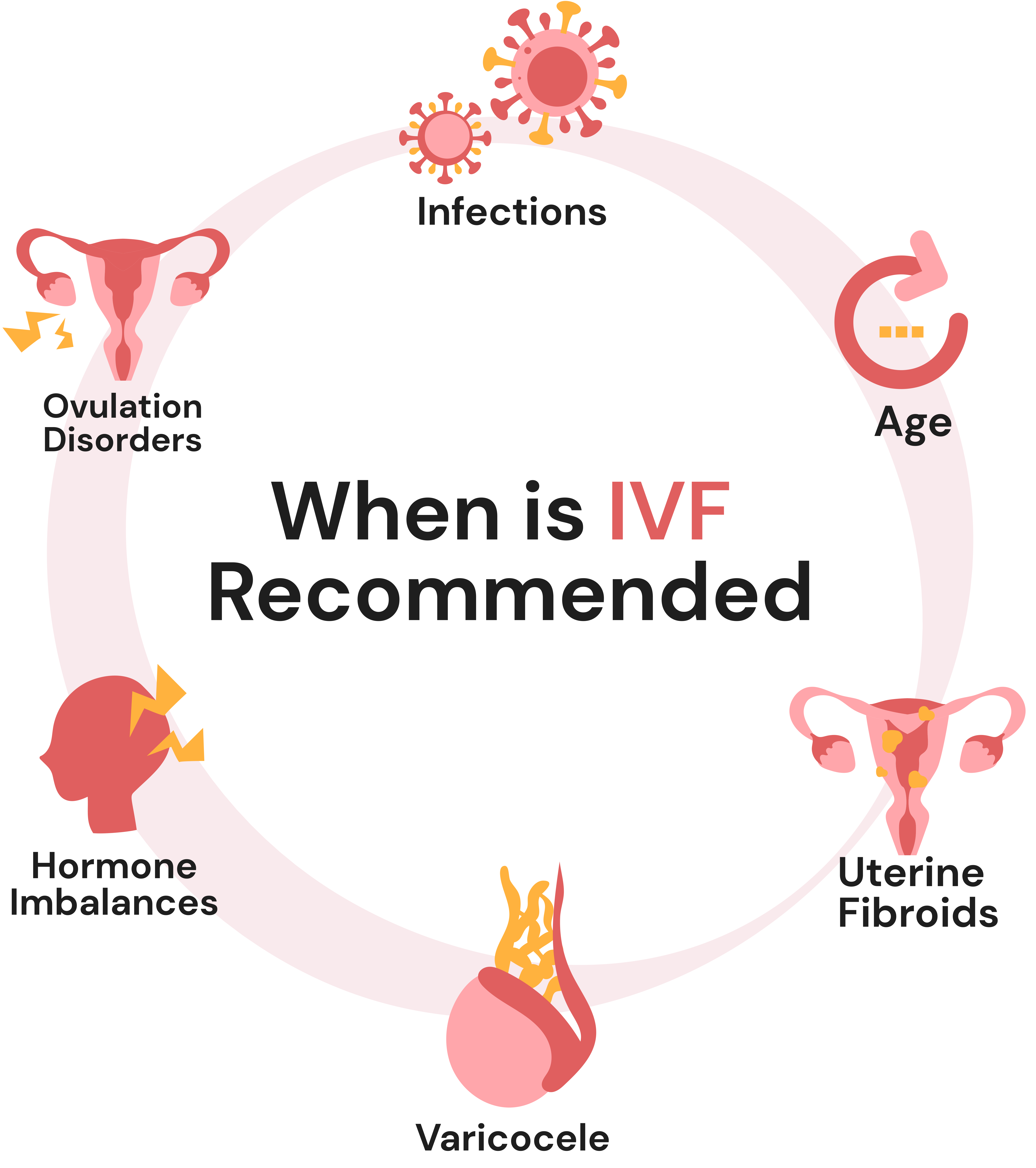 When is IVF Recommended Chennai?